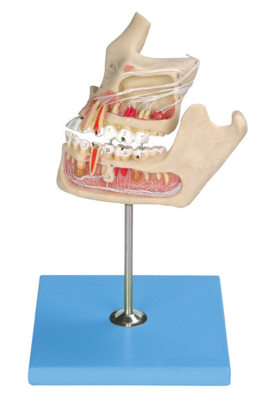 Modèle humain pathologique de dents/modèle de mâchoire avec colorimétrique par ordinateur environ deux parts