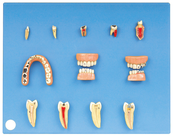 Modèle dentaire des maladies fait de PVC avancé pour le stage et la formation d'étudiants