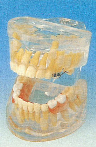 Modèle humain de dents d'écoles dentaires/modèle transparent de développement de dents de lait