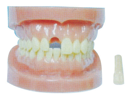 Modèle détachable de dents sans racine pour des hôpitaux et la formation dentaire de prévention