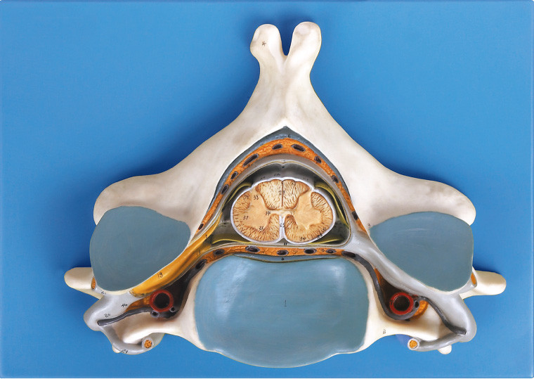 Cinquième Vertrebra cervical avec le modèle squelettique humain anatomique de moelle épinière et de nerf