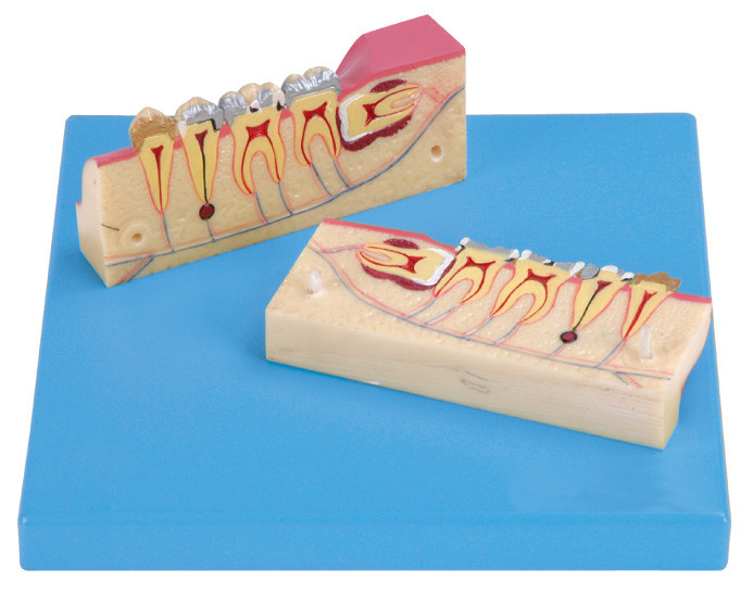 12 positions sont montrées du modèle Dissected du tissu de dents