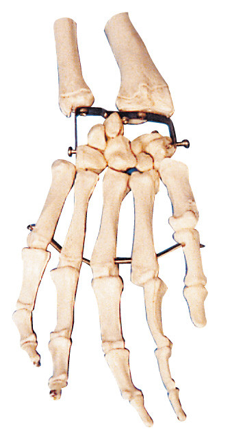 Modèle de formation humain de modèle d'anatomie d'os de paume pour la Faculté de Médecine