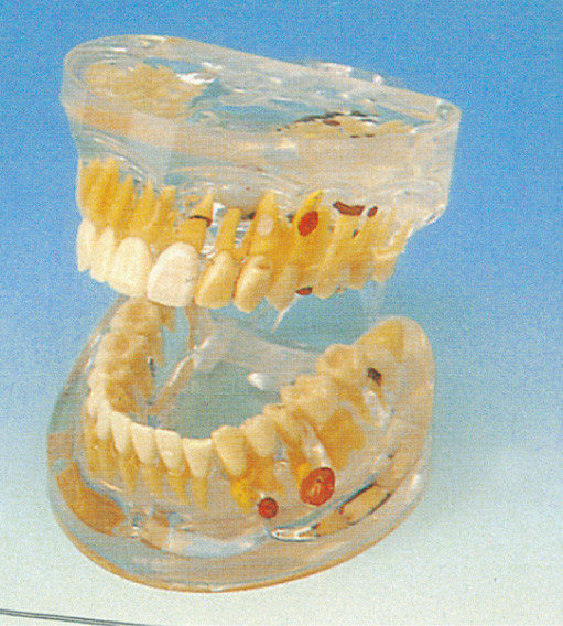 Modèle humain de dents de pathologie dentaire transparente adulte pour la formation d'universités