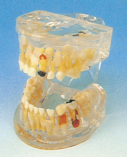 Le modèle humain de dents/pathologie lucide des dents de lait modèlent pour la formation d'écoles dentaires