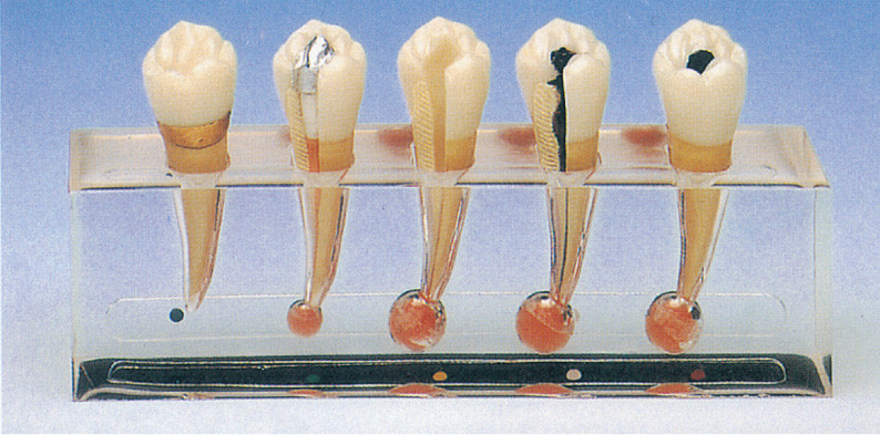 Le modèle clinique de pathologie de l'Endodontics inclut 5 parts pour la formation de clinique