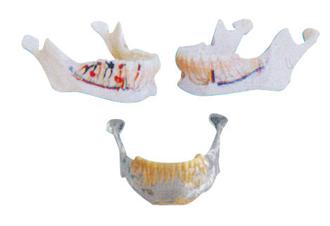 Les dents de dentiste modèlent le modèle mandibulaire avec des nerfs, des artères et des veines