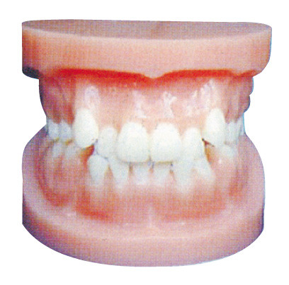 L'implant dentaire modèle/modèle orthodontique pour la formation anatomique