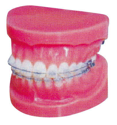 Modèle orthodontique fixe normal pour la formation d'hôpitaux et de Facultés de Médecine