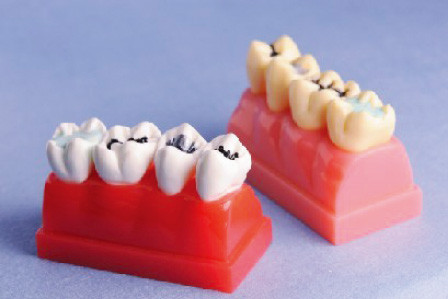 Modèle humain de dents pour le modèle de démonstration de mastic et de marqueterie de 4 fois grandeur nature