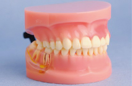 Modèle de modèle humain de dents de maladie parodontale pour les universités médicales et la formation de clinique