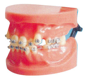 Modèle orthodontique fixe de dislocation pour l'université médicale et la formation dentaire d'hôpital